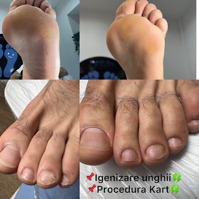 Pedichiura cu nota medicala Bucuresti-Happy Feet Medical